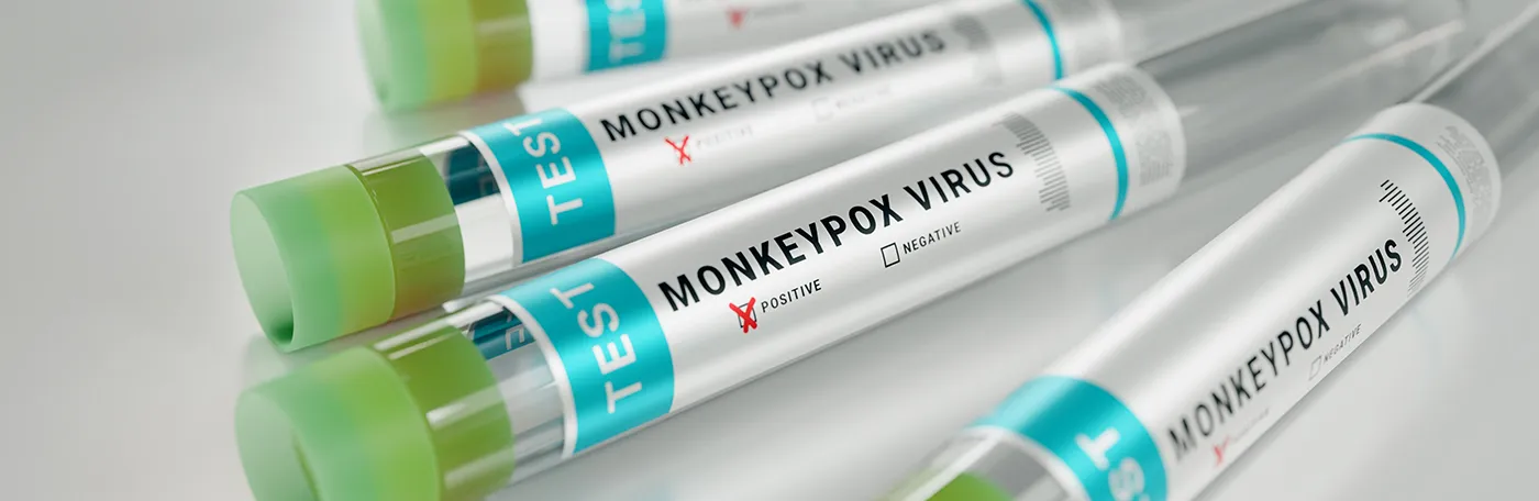 A close up of vials labeled mpox virus